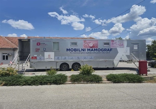 U Topoli i Batočini Mobilni mamografi od 9. jula